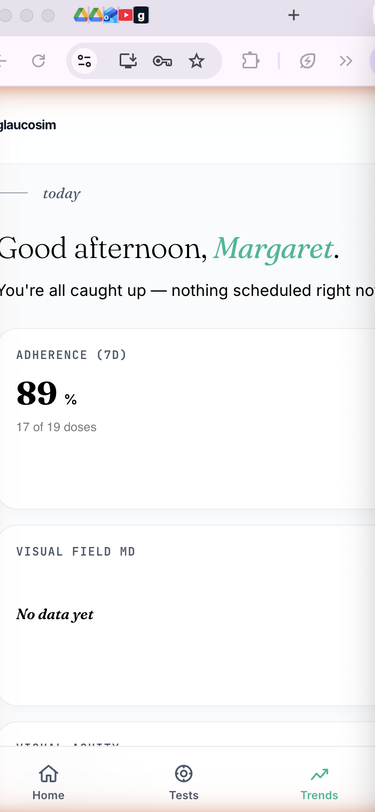 Glaucosim patient trends screen on iPhone — adherence 89%, visual field MD, visual acuity