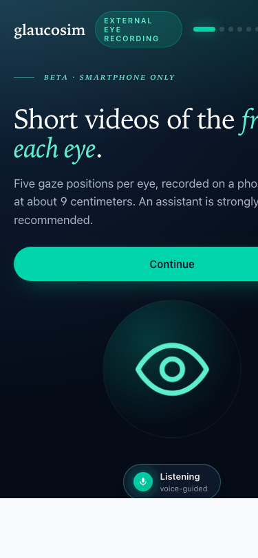 GlaucoSim anterior segment recording on iPhone