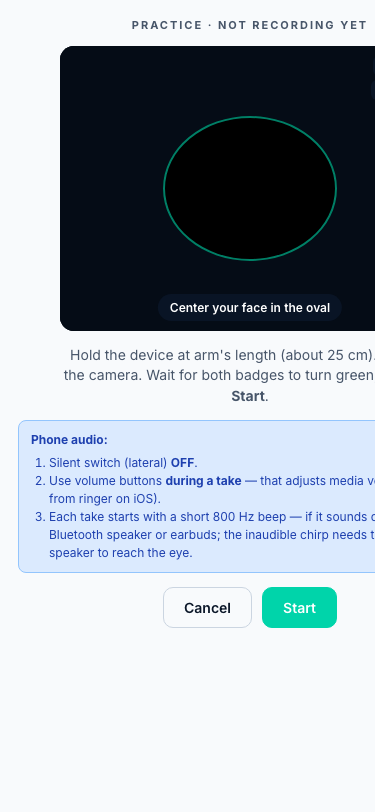 GlaucoSim contactless acoustic IOP screening on iPhone